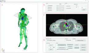 View latest posts and stories by @voxel_rl in instagram. Software Tool For Tracking Of Voxel Phantom S Anatomical Features Springerlink