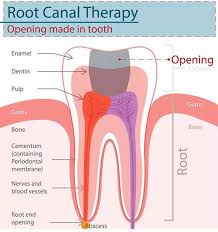 root c therapy in artesia nm
