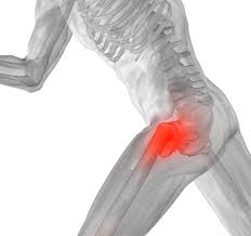 hip pain how to treat it and why
