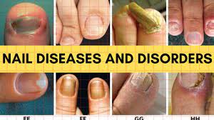 nail diseases and disorders you