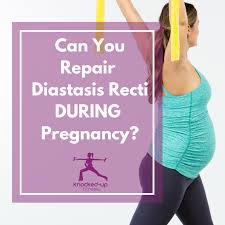 Helping to prevent diastasis recti. Can You Repair Diastasis Recti During Pregnancy Video Knocked Up Fitness
