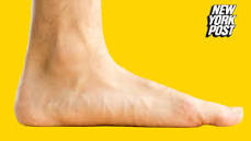 why-do-ufc-fighters-have-yellow-feet