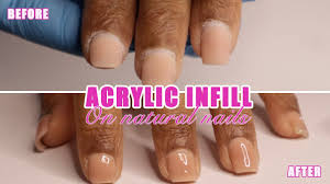 acrylic overlay nail infill tutorial
