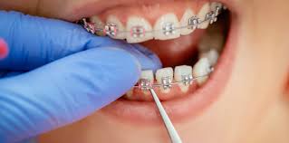 ••• gigi si manja sepatutnya masih sihat, jadi mengapa ia kelihatan kelabu? Penjagaan Berus Gigi Jangan Ambil Mudah Hello Doktor