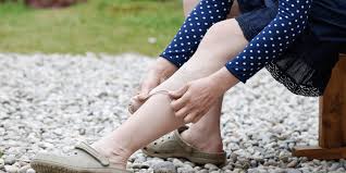 how to cover varicose veins by the