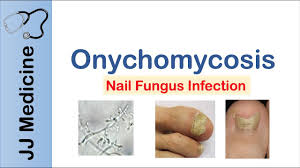 nail disorders diseases cosmetology