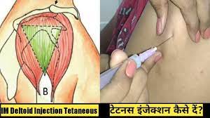 painless injection tet shot at home