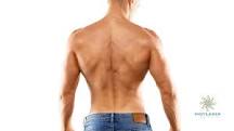 how-common-is-a-hairy-back