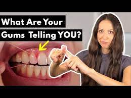 why do gums hurt bleed after flossing