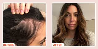 hair thinning causes in women women