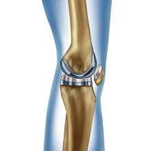 attune knee system lawsuit best