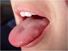 what your tongue tells you about your