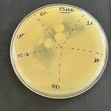 128 questions with answers in lb agar