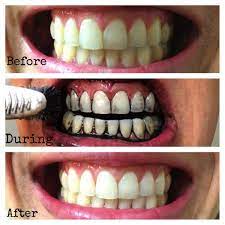 It's one of the six tooth care recipes i share in my ebook, diy organic beauty recipes. 10 Tips To Whiten Your Teeth Naturally Home Remedies Cumsafacsingur Ro