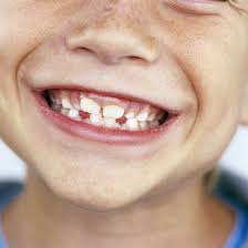 A loose tooth is cause for concern unless it is a baby tooth making way for the permanent tooth coming through. Losing Baby Teeth Parents