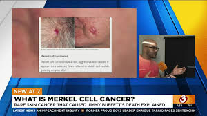 what is merkel cell cancer you