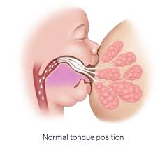 infant tongue ties lip ties dr