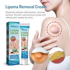 natural herbal lipoma removal cream