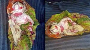 Harlequin ichthyosis is a rare, congenital skin condition. Harlequin Ichthyosis Mother Abandons Baby With Shell Like Skin