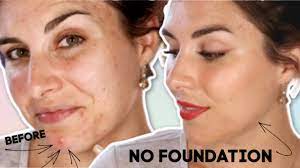 cover acne scars without foundation