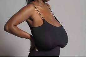 what causes breasts to sag at a young age
