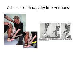 achilles tendinopathy and mend physical