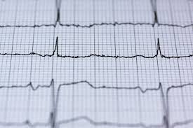 Israeli Fetal Heart Rate Monitor To Launch In Australia