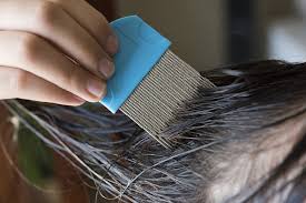 how to remove lice eggs from hair using