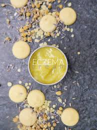 soothing diy eczema cream label