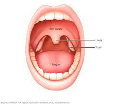 Tonsil Tumour gambar png