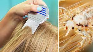 natural lice removal treatment