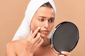 acne mistakes you might be making