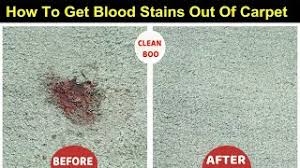 how to remove dried blood stains from