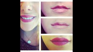 Mit dem hyaluron pen bekommst du volle lippen ohne nadel und vollkommen schmerzfrei. Lippen Aufspritzen Und Botox Vorher Nachher Meine Erfahrung Youtube