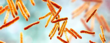 Tuberculosis (tb) is a disease caused by bacteria called mycobacterium tuberculosis. Mycobacterium Tuberculosis Komplex Tuberkulose 2020 Symptome Ubertragung Behandlung Hygiene In Practice