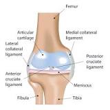 Image result for icd 10 code for arthrofibrosis of left total knee arthroplasty