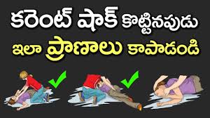 First Aid Treatment For Electric Shock Tips To Save