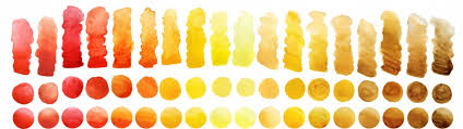 when urine isn t yellow a color coded