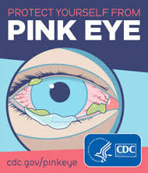 is pink eye conious advanced