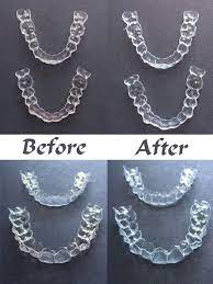 Cleaning your retainer will require toothpaste, a retainer brush, and retainer cleaner. Bluehost Com Invisalign Invisalign Hacks How To Clean Invisalign