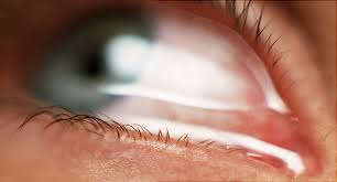 Apple of my eye phrase. 12 Conditions That Cause Watery Eyes