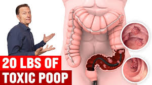 colon cleanse fact or fiction 5 to 20
