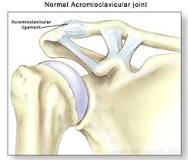 Image result for icd 10 code for right shoulder ac separation