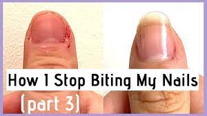 how i stop biting picking my nails in