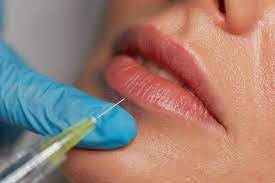 lip fillers guide benefits risks