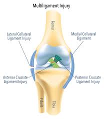 al collateral ligament mcl injury