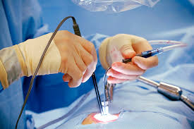 laparoscopic surgery ile ilgili görsel sonucu