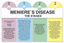 A Little Bit About Menieres Disease Meneires Disease