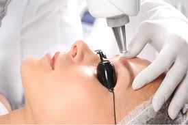 affirm multiplex laser skin renewal