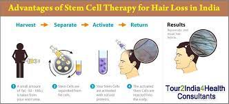 stem cell therapy for hair loss